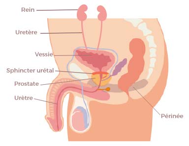 Les fuites urinaires masculines